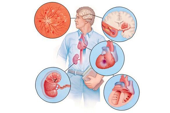 Damage to various organs in long-term arterial hypertension